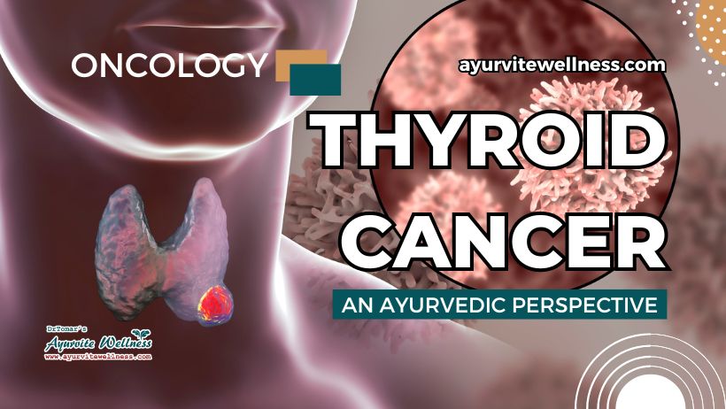 Treatment of Thyroid cancer