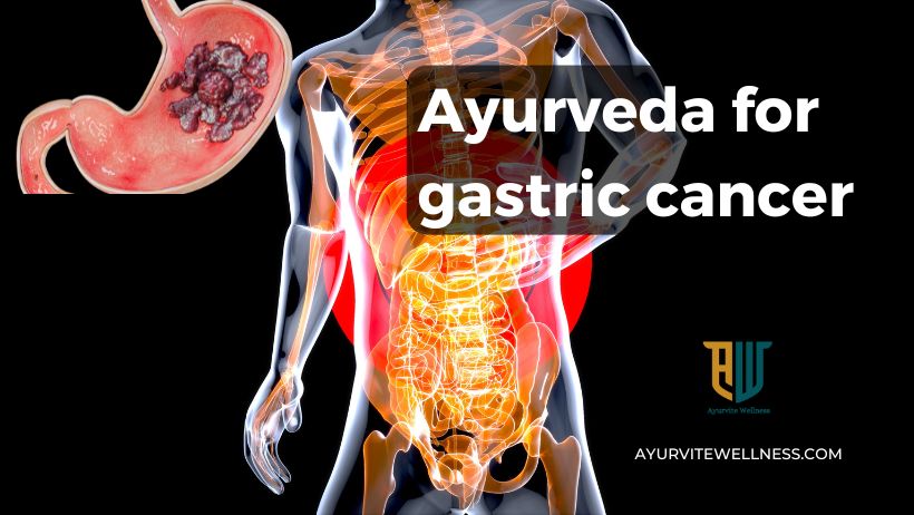 Ayurveda for gastric cancer